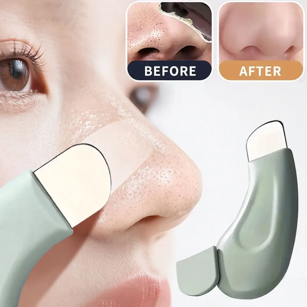얼굴의 블랙헤드 제거 도구, 깊숙이 세정하는 페이셜 스 - Nasal Aspirator 리뷰 및 가격